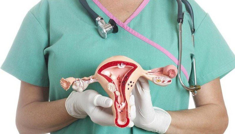 Ung thư buồng trứng: Nguyên nhân, dấu hiệu nhận biết, các giai đoạn phát triển | Vinmec
