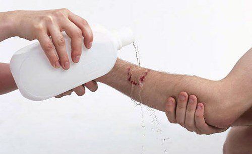 Nhấn vào ảnh để phóng to
Vết thương cần được rửa kỹ với cồn 70 độ.