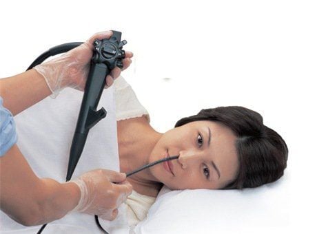 Nasal Gastroscopy