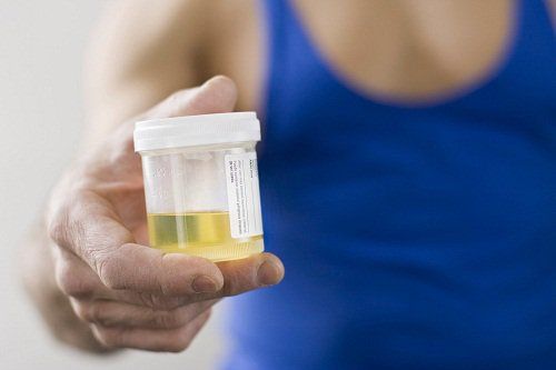 Cần thường xuyên kiểm tra nước tiểu trong các lần khám thai để theo dõi, phòng tránh tình trạng mẹ bầu bị viêm đường tiết niệu.