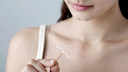 Đặt vòng tránh thai giúp ngăn không cho tinh trùng và trứng gặp nhau