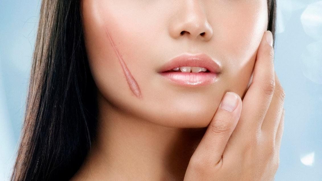 Loại củ nào sau đây có thể giúp cho vết thương mau lành và ít để lại sẹo?