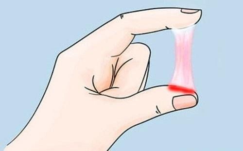 Abnormal vaginal discharge can be a sign of vaginal discharge disease: