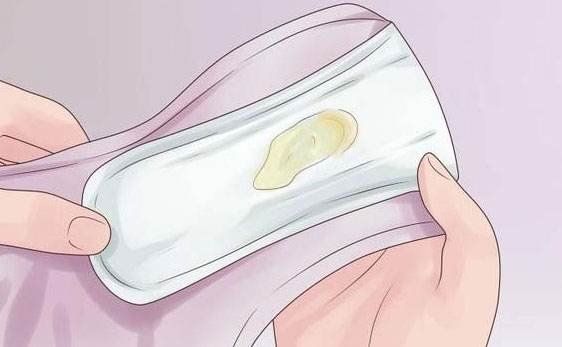 Sự thay đổi của khí hư báo hiệu sắp đến kỳ kinh nguyệt | Vinmec