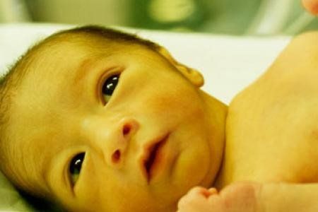 High bilirubin in the blood will penetrate the tissue, causing jaundice