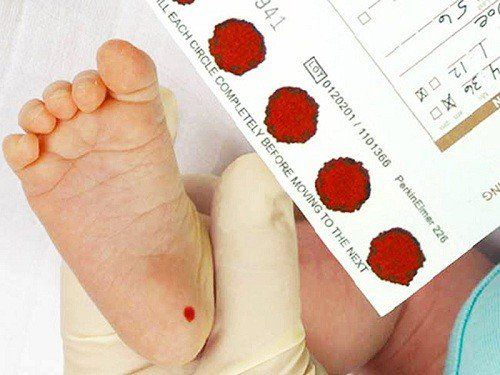 Trẻ sau sinh từ 48 đến 72 giờ được tiến hành lấy máu gót chân để phát hiện nguy cơ mắc bệnh
