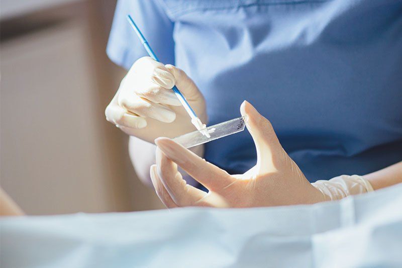 TẦN SUẤT THỰC HIỆN XÉT NGHIỆM PAP SMEAR THEO KHUYẾN CÁO CỦA CHUYÊN GIA Y TẾ
