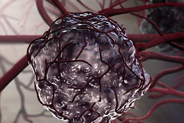 U butalar orasida chayqalib yurardi U butalar orasida chayqalib yurardi