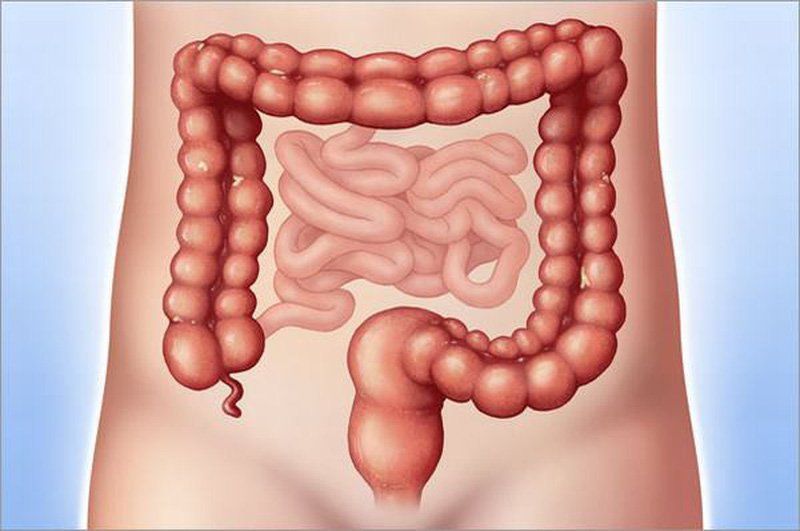 Cắt polyp đại tràng: Ưu điểm và những lưu ý sau khi cắt | Vinmec