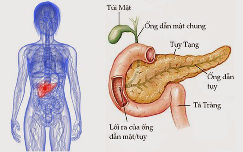 Viêm tuyến tụy