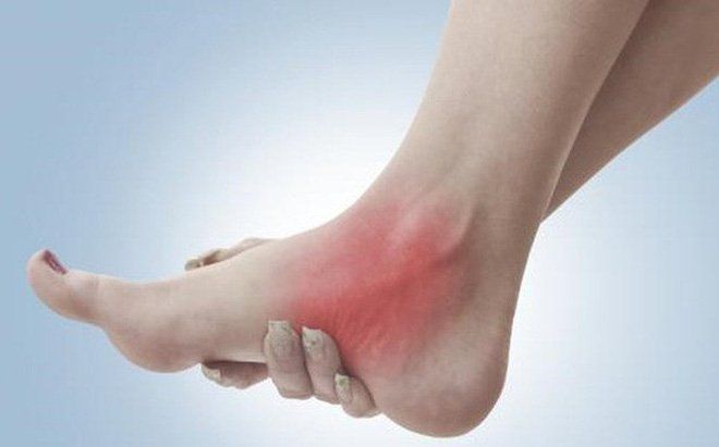 Bong gân cổ chân: vì sao dễ tái phát sau khi hết đau?