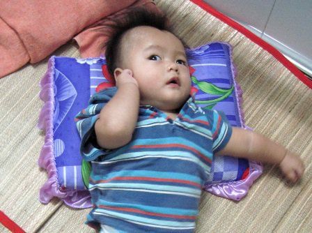 Mức độ ảnh hưởng của các tác dụng không mong muốn này có thể nặng hay nhẹ tùy thuộc vào thể trạng của mỗi bệnh nhân