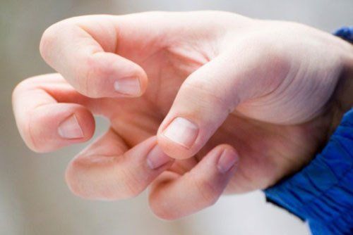 Động kinh là một rối loạn thần kinh đặc trưng bởi các cơn co giật không kiểm soát