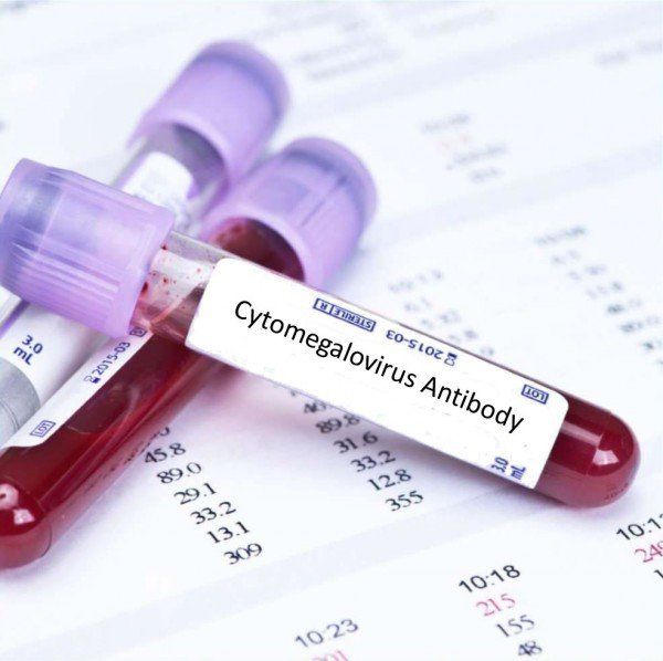 Chẩn đoán và điều trị nhiễm virus cytomegalo (CMV) | Vinmec
