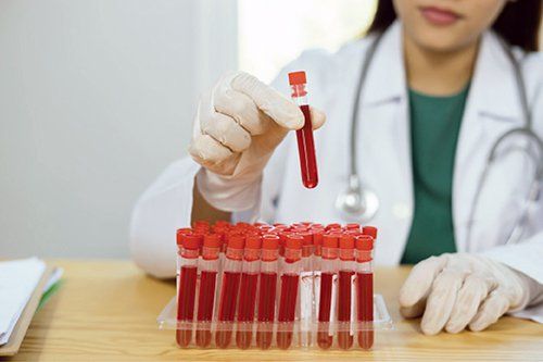 Định lượng anti Xa đánh giá nồng độ heparin có trong máu, đặc trưng bởi sự kháng đông máu