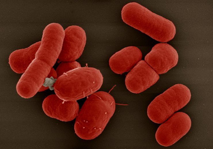Tìm hiểu vi khuẩn Klebsiella Pneumoniae | Vinmec