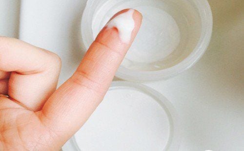 Excessive White, Clumpy, Foul-Smelling Vaginal Discharge – What Should You Do?