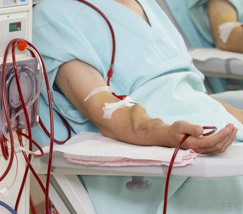 Lọc màng bụng và chạy thận nhân tạo: Nên chọn cách nào? | Vinmec