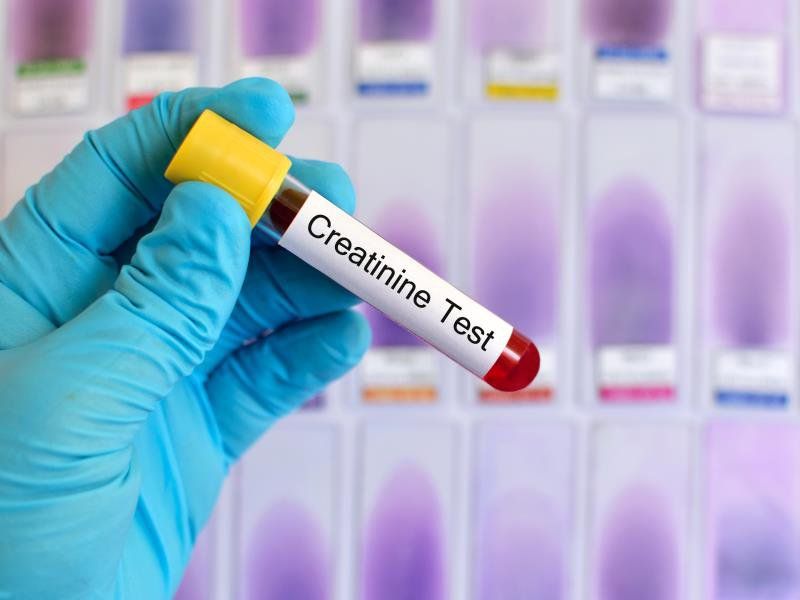 Các câu hỏi thường gặp về xét nghiệm creatinin trong máu | Vinmec