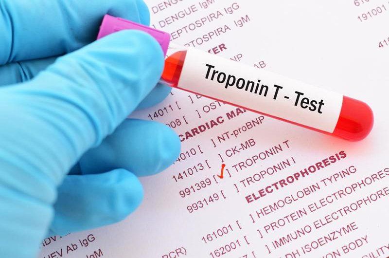 Xét nghiệm troponin T trong đánh giá suy tim, nhồi máu cơ tim | Vinmec