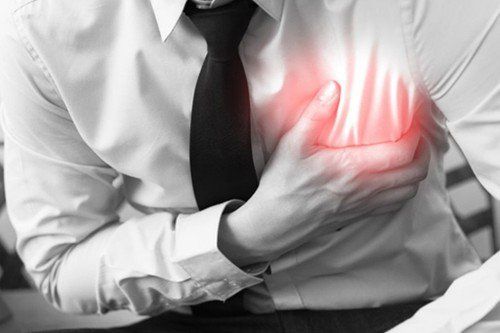 Bệnh nhân đau thắt ngực nhẹ được chỉ định thực hiện