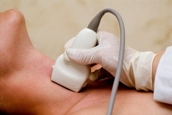 Siêu âm Doppler là phương pháp không xâm lấn hiệu quả nhất để tầm soát hẹp động mạch cảnh 