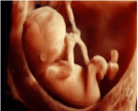 Siêu âm 2D là phương thức hình ảnh ưu tiên để chẩn đoán và theo dõi phụ nữ mang thai và thai nhi