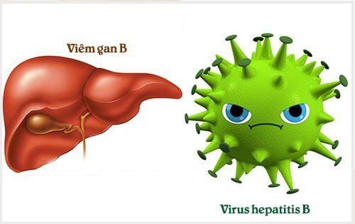 Virus viêm gan B có thể gây ra ung thư gan