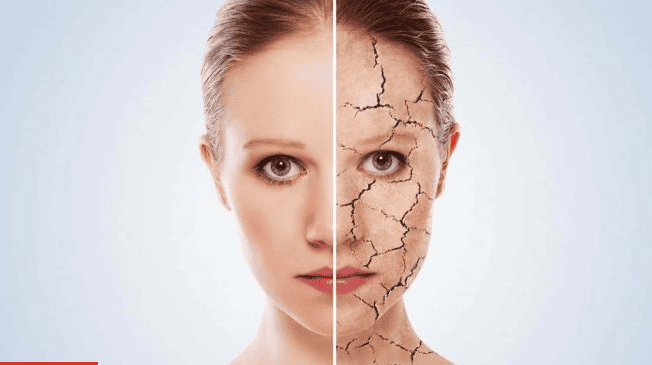 Ảnh hưởng của mất nước với cơ thể | Vinmec