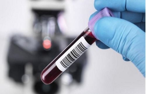 Xét nghiệm Anti-HBc IgM giúp chẩn đoán viêm gan B ở giai đoạn cấp tính.