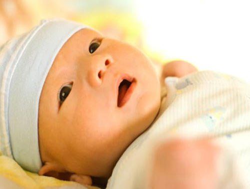 Vàng da là triệu chứng phổ biến ở trẻ sơ sinh mắc suy tuyến giáp