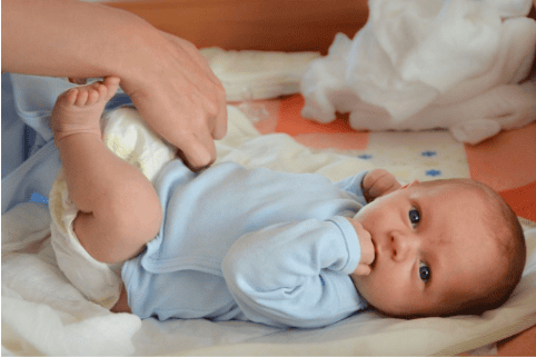 Nước tiểu của trẻ sơ sinh màu vàng có thể do dinh dưỡng hoặc bệnh lý gây ra