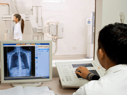 X-quang thực quản là phương pháp chẩn đoán hình ảnh cổ điển là chụp thực quản có sử dụng thuốc cản quang, nhưng vẫn có giá trị cao trong việc định vị tổn thương và xác định mức độ lan rộng của tổn thương tại thành thực quản