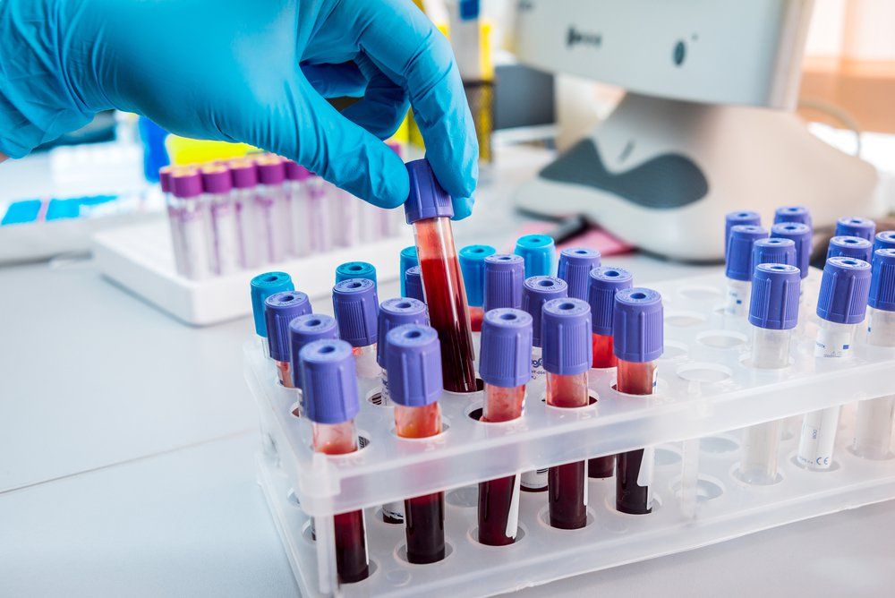 What is WBC blood cell and what does WBC test indicator mean?