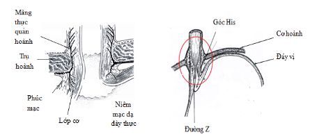 Hình 3: Cơ thắt dưới thực quản, góc His, màng thực quản – hoành đóng vai trò quan trong trong bệnh lý trào ngược dạ dày – thực quản