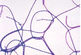 Mẫu cấy nhuộm Gram này cho thấy các chuỗi vi khuẩn Bacillus anthracis hình que, gram dương.
