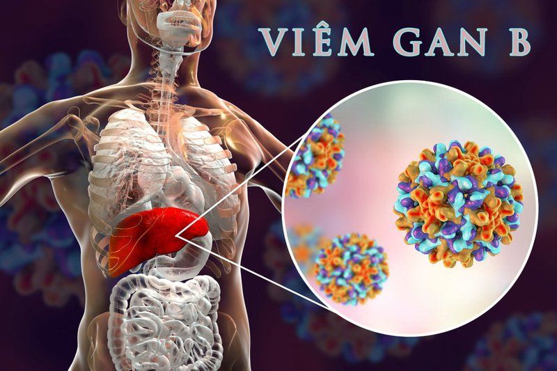 Viêm gan B có phải uống thuốc không? | Vinmec