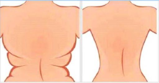BÀI TẬP GIẢM MỠ LƯNG VÀ NÁCH GIÚP VÙNG CÁNH TAY SĂN CHẮC VÀ THON GỌN HƠN THEO THỜI GIAN