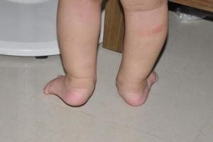 Slide item