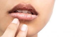 Khô miệng là một trong những nguyên nhân gây sâu răng