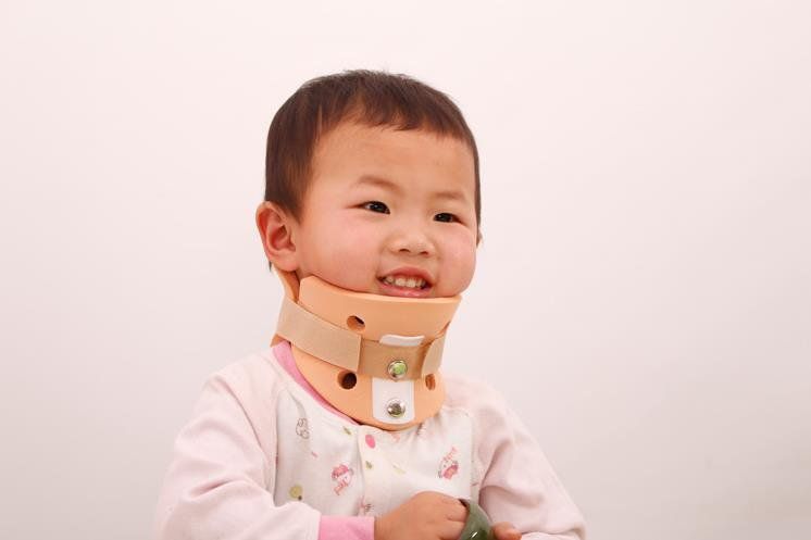 Coi chừng chứng vẹo cổ ở trẻ nhỏ