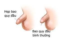 Slide item