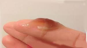 Slide item