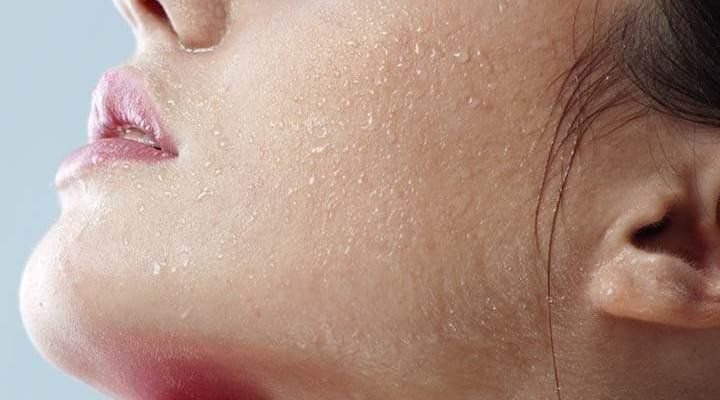 Da khô nghiêm trọng: Nguyên nhân, cách khắc phục và phòng ngừa | Vinmec