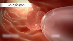 Sau 18 ngày chuyển phôi bị ngứa dị ứng có ảnh hưởng gì không?