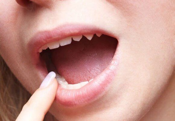 9 nguyên nhân gây khô miệng khi ngủ dậy | Vinmec