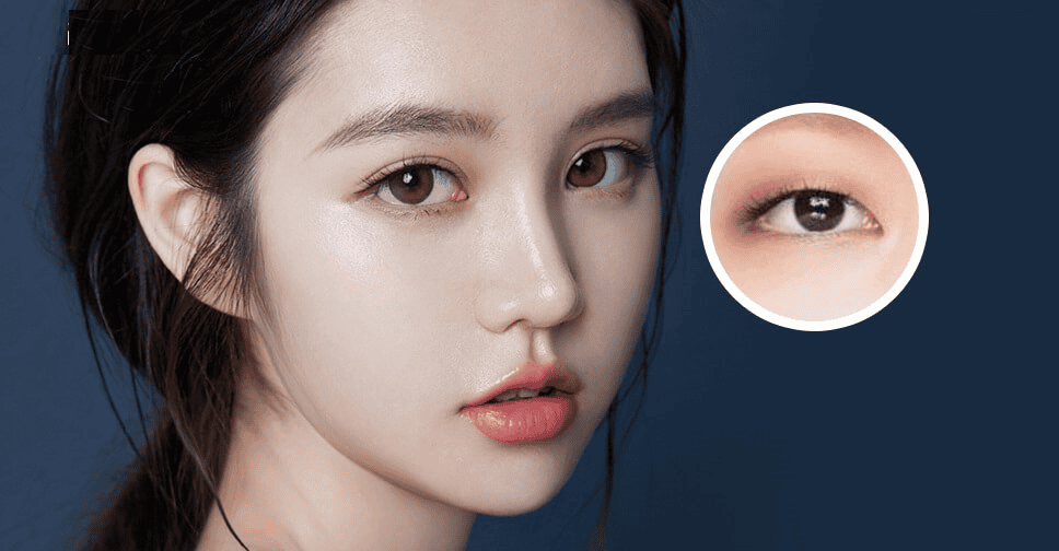 Nhấn mí mắt có sưng hay không? | Vinmec