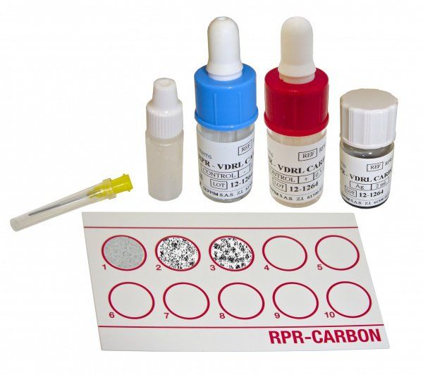 Chỉ số xét nghiệm RPR âm tính cho biết điều gì? | Vinmec