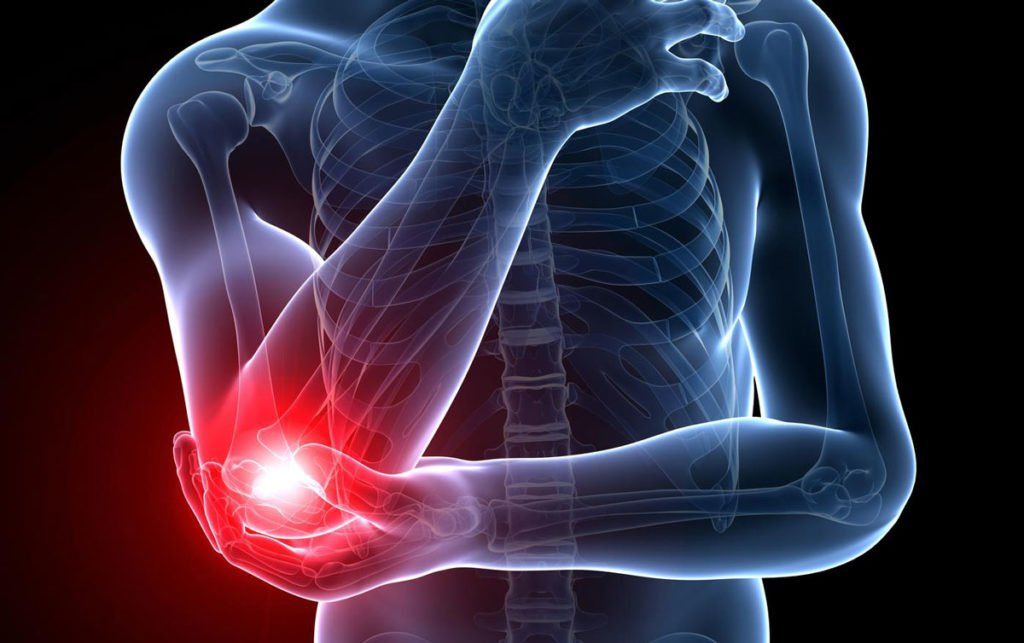 Gãy vỡ xương khuỷu tay gây mất xương: Nguyên nhân, triệu ...