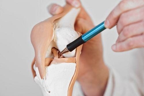 Để xác định phương pháp điều trị phù hợp, bao gồm cả việc rách sụn chêm có cần phải phẫu thuật hay không, việc chẩn đoán chính xác là vô cùng quan trọng.
